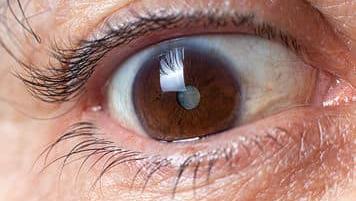 Czy zaćma może występować jako choroba dziedziczna?