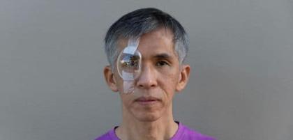 Czy po operacji zaćmy istnieje ryzyko nawrotu choroby?