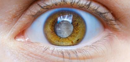 W jaki sposób można usunąć zaćmę?