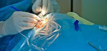 Na czym polega operacja zaćmy?